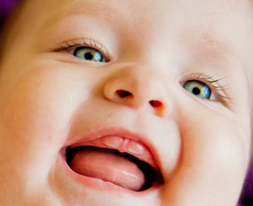 Why Do Babies' Gums Turn Yellow?