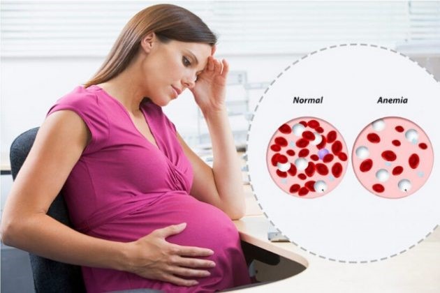 Understanding Pregnancy-Related Anemia Risks